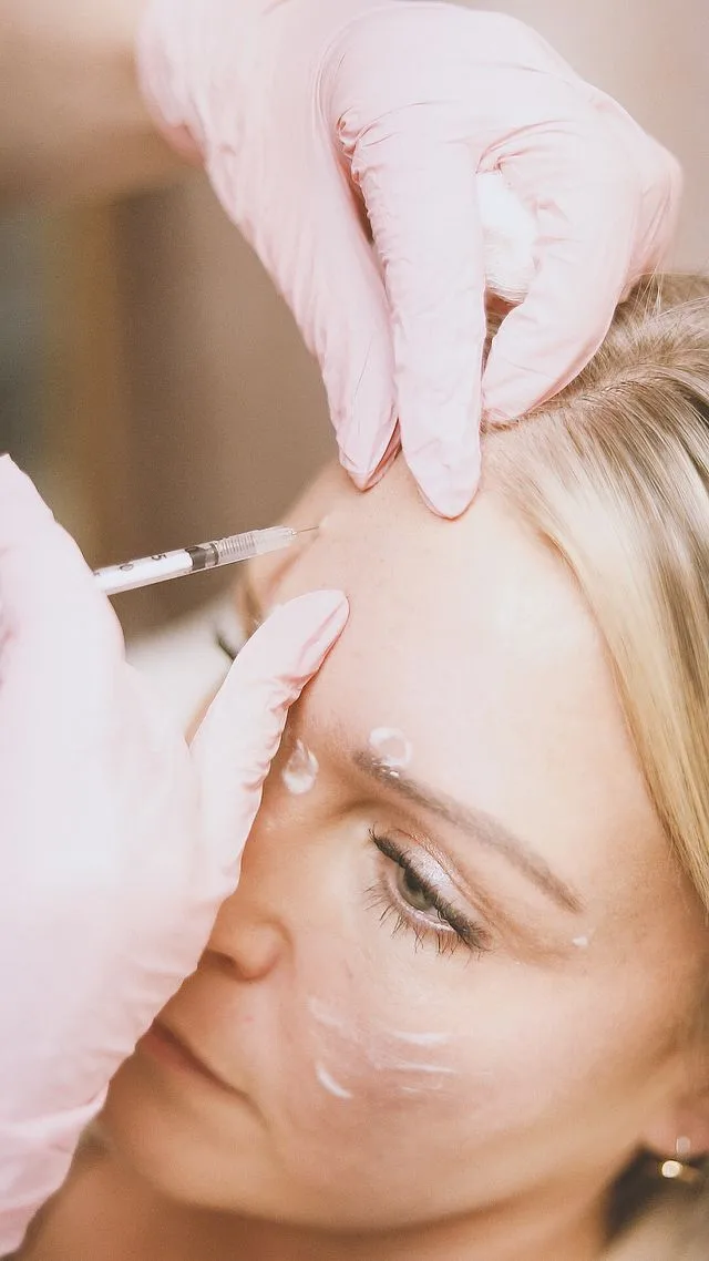 Dermal fillers